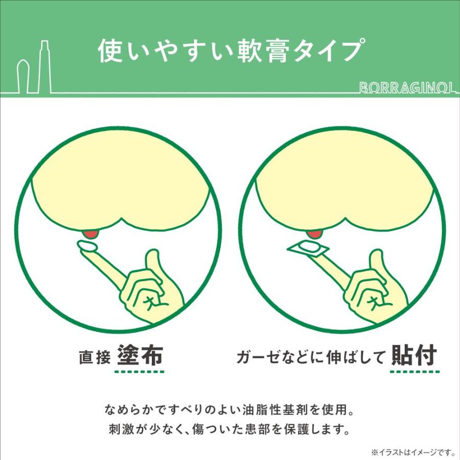 ボラギノール 軟膏 塗り 方