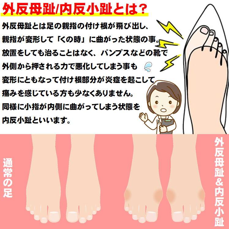外反母趾サポーター カサハラ式 靴下 足指 広げる 親指 矯正 小指