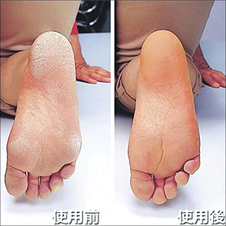 かかとケア ソックス ひび割れ 足裏 踵 保湿 乾燥 かかとつるつる 対策 角質 除去 かかとケアソックス 簡単 ツルツル 潤う しっとり エステソックス 日本製 F 0060 K サンロードヤフー店 通販 Yahoo ショッピング