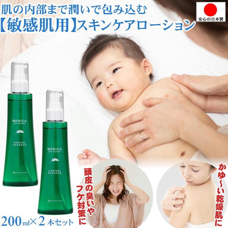 赤ちゃん 保湿 ベビーローション あせも 湿疹 おむつかぶれ 子供