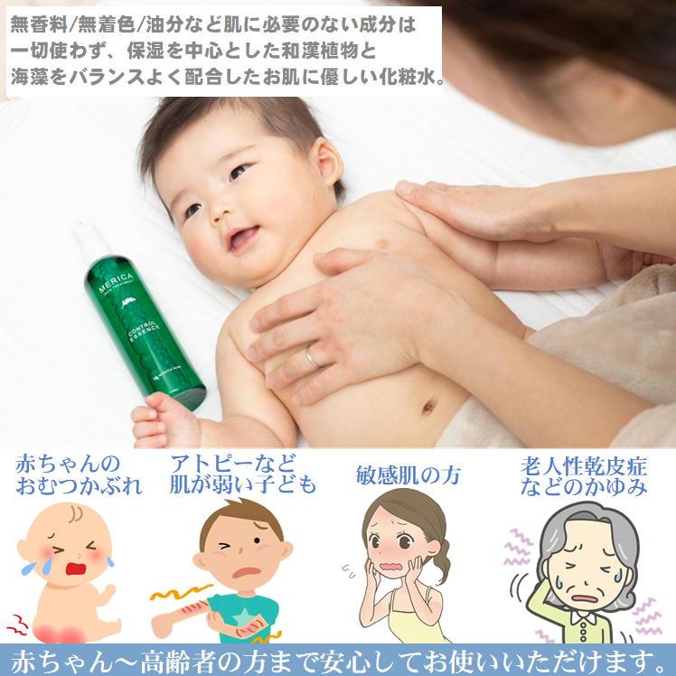 敏感肌用　スキンケア 敏感肌用化粧水 乾燥肌 スキンケア 赤ちゃん 保湿 湿疹 かゆみに効く