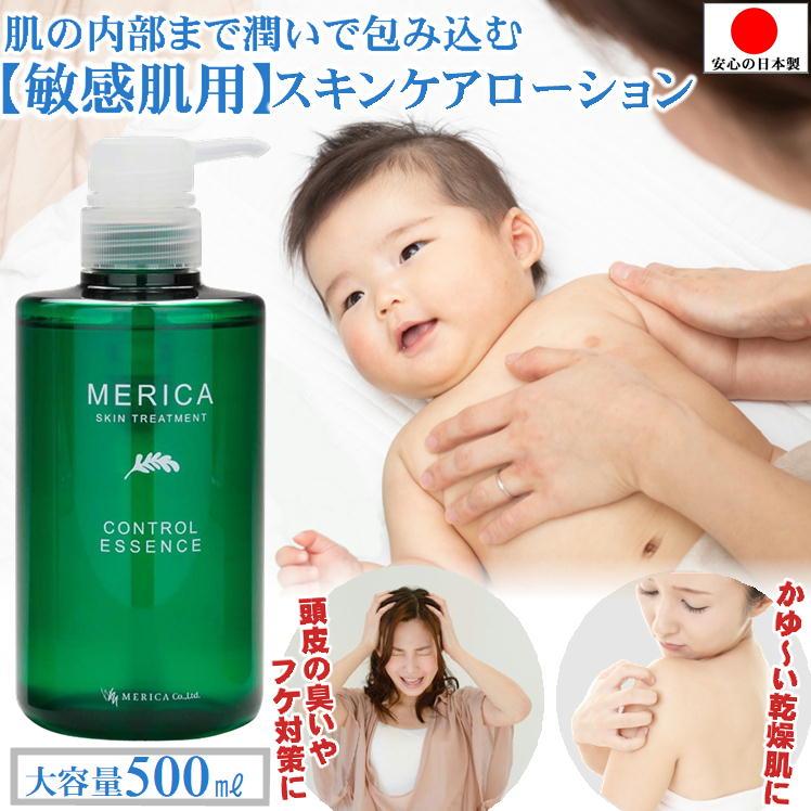 乾燥肌 かゆい スキンケア 敏感肌 化粧水 かゆみ止め 子供 赤ちゃん 低