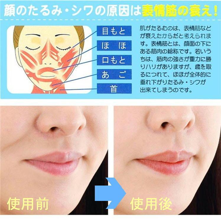 小顔 顔やせ ダイエット リフトアップ ほうれい線 顔 頬 しわ たるみ 二重あご 解消 便利 グッズ 痩せる 表情筋 鍛える トレーニング 日本製 フェイストレッチ S1146 J 0 サンロードヤフー店 通販 Yahoo ショッピング