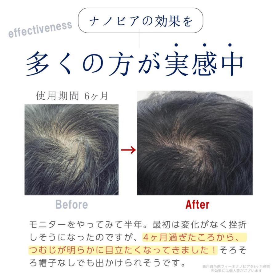 薬用 育毛剤 女性用 レフィーネ ナノビア 1ml 2本セット レディース 低刺激 おすすめ 臭わない 育毛 発毛 薄毛 医薬部外品 Na212 ヘアケア専門店レフィーネ 通販 Yahoo ショッピング