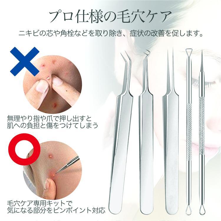 50%OFF! 毛穴ケア専用キット 5本セット ケース付 角栓 ニキビ取り毛穴ケア 黒ずみ 角栓取り ニキビ 取り 毛穴ケア 角栓除去 ピンセット グッズ 黒ずみ