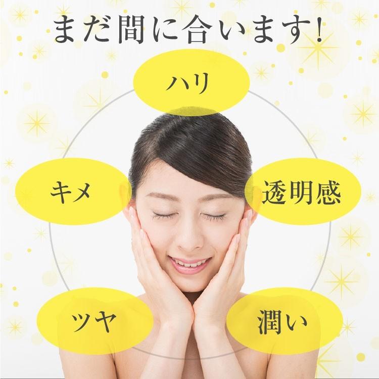 ヒト幹細胞 化粧水 化粧品 RCH SC ピュア ローション(120mL) お得な3本