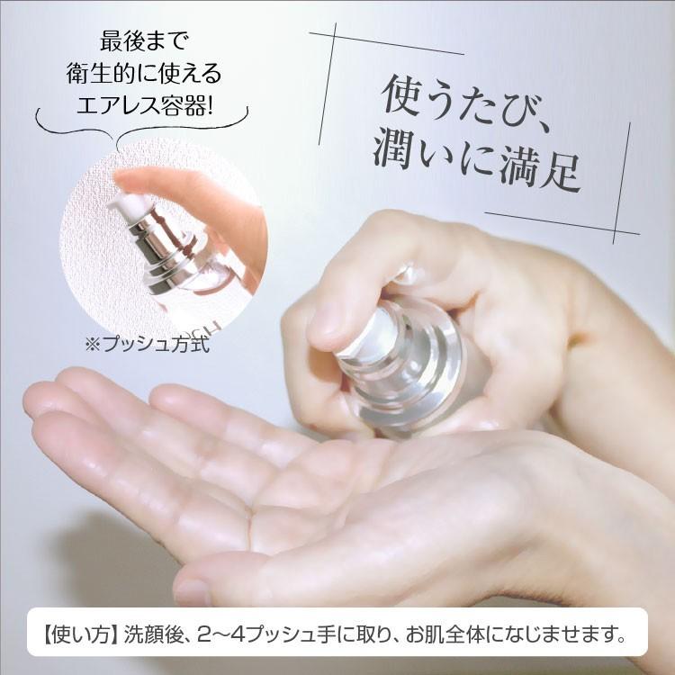ヒト幹細胞 化粧水 化粧品 RCH SC ピュア ローション(120mL) お得な3本