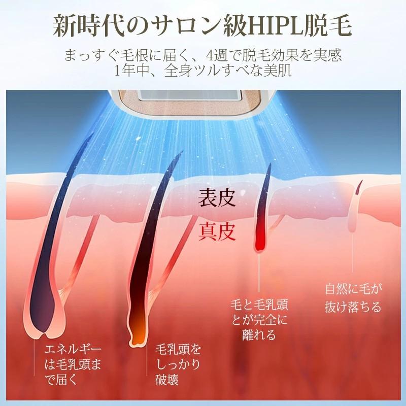 【新品未使用】① 脱毛器　無痛脱毛　VIO対応　男女兼用　光美容器　HIPL冷感 Amazon | 脱毛器 vio対応 【サロン級HIPL光脱毛器・99万発照射】 家庭