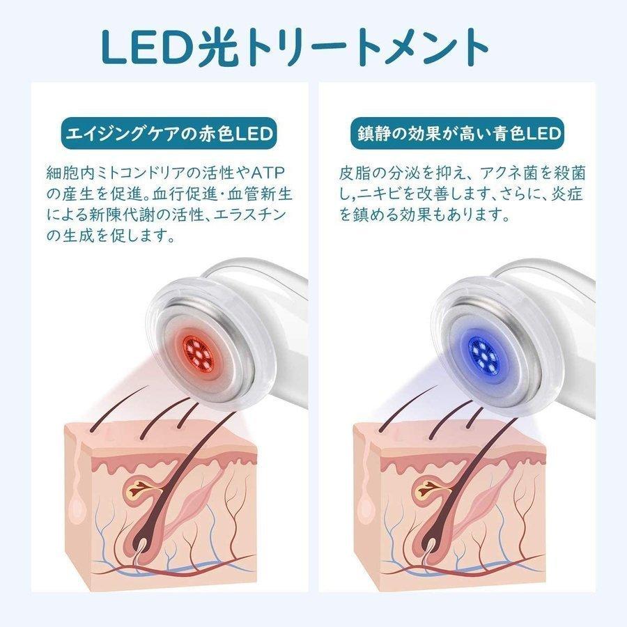 超音波美顔器 Benow イオン導入 多機能美容器 超音波振動 顔 超音波美顔器 Benow イオン導入 多機能美容器 超音波振動 顔