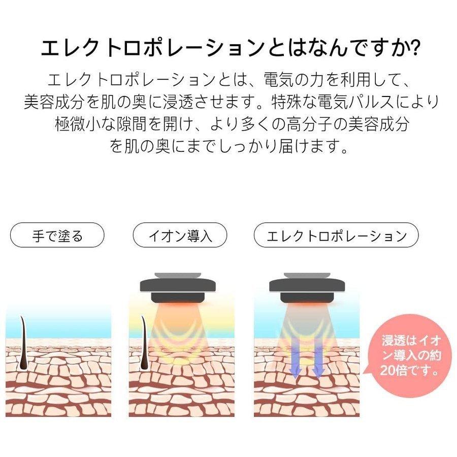 超音波美顔器 多機能 美顔器 イオン導入器 1台5役 RF美顔器 超音波美顔器 多機能 美顔器 イオン導入器 1台5役 RF美顔器