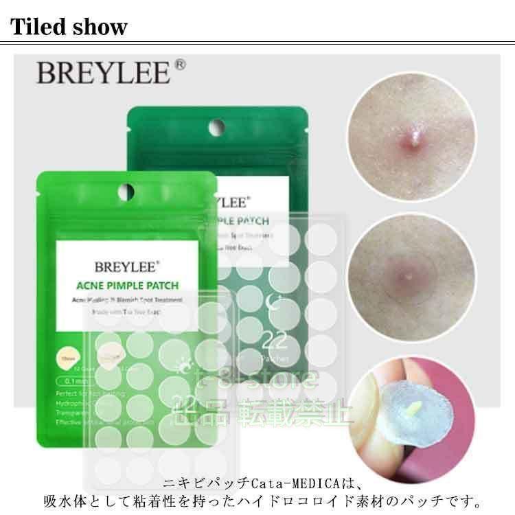 ニキビ洗浄用　OH UI 楽天市場】iow SFパック 硫黄 イオウ 肌荒れ ニキビ 洗顔 毛穴