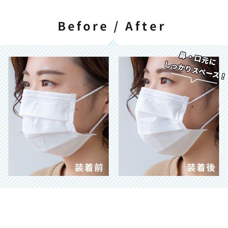 10個セット マスク イン ガード マスク補助フレーム マスクインナー