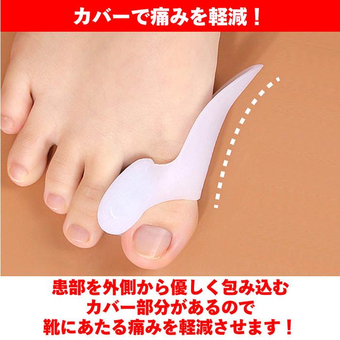 外反母趾 サポーター 2組セット 外反母趾保護カバー 足指 親指