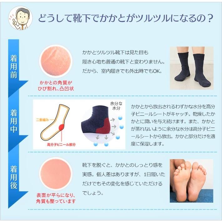 【NEW】かかとツルツル靴下 口ゴムゆったり＆ロング丈 毛混 かかと保湿 かかと角質ケア かかとのガサガサ ひび割れ かかと靴下 23-25cm 649-2021 太陽ニット｜taiyounitto｜05