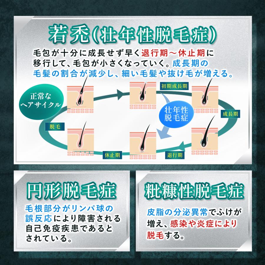 公式 ニューモ ニューZ 4本 薬用 育毛剤 60ml 第二類医薬品 株式 公式 ニューモ ニューZ 4本 薬用 育毛剤 60ml 第二類医薬品 株式