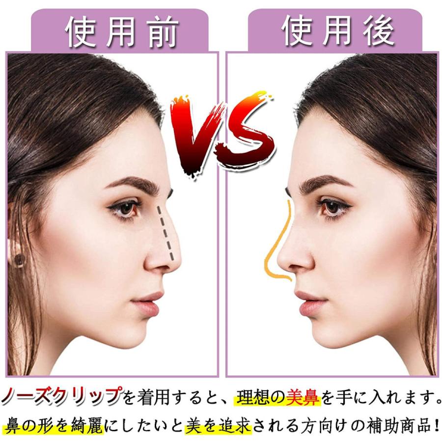 鼻プチ 矯正効果