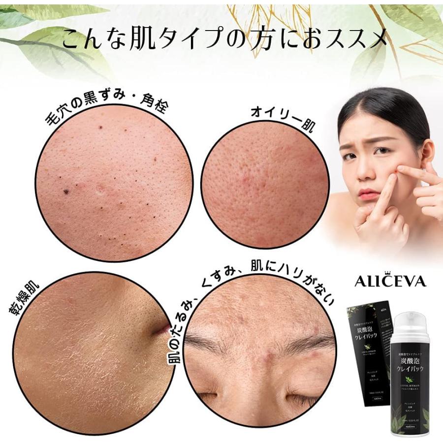 流行に 入浴用品 アリセバ Aliceva 炭酸泡パック 泡洗顔料 毛穴パック クレンジング 洗顔 メイク落とし スッキリ バブルパック スキンケア フェイスケア 黒 Www Threeriversofs Com