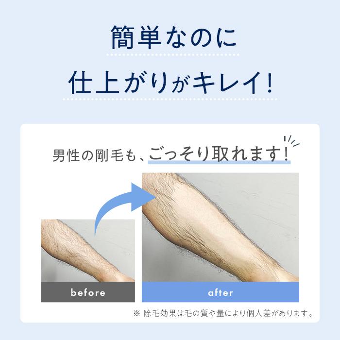 TBC脱毛　保湿 MEN'S TBC エピリムーバーⅡ_200g: TBCボディケア｜TBC