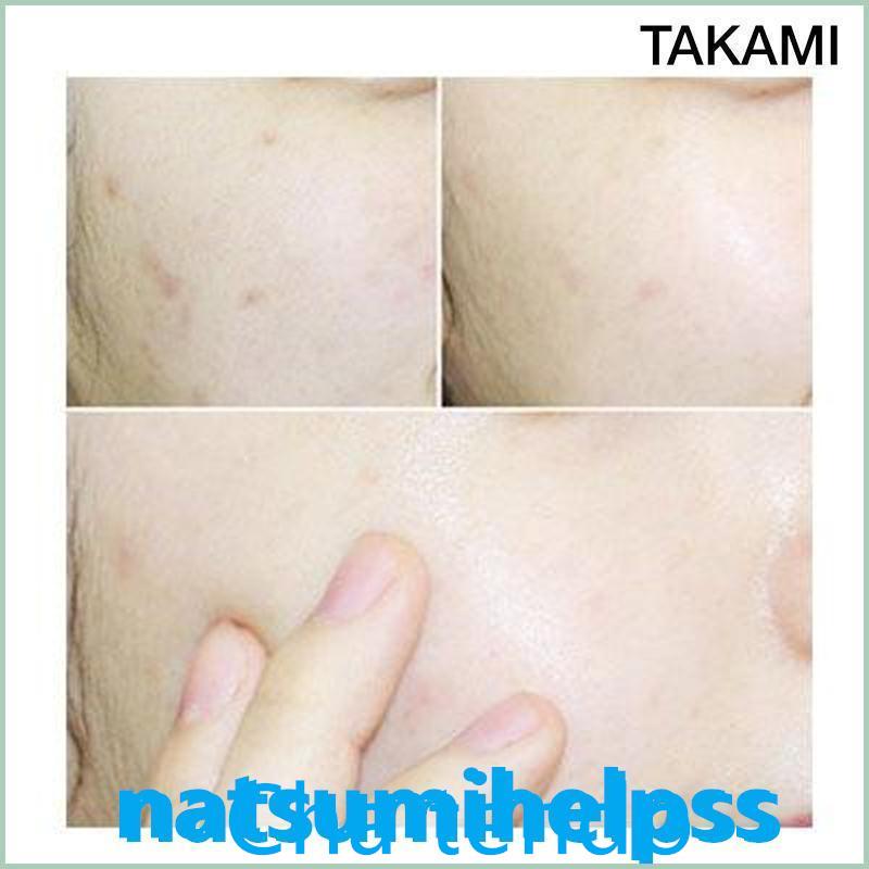 【限定セール】TAKAMI タカミスキンピール 30mL 2本セット(角質ケア化粧液) 導入美容液 正規品｜teateattt｜09