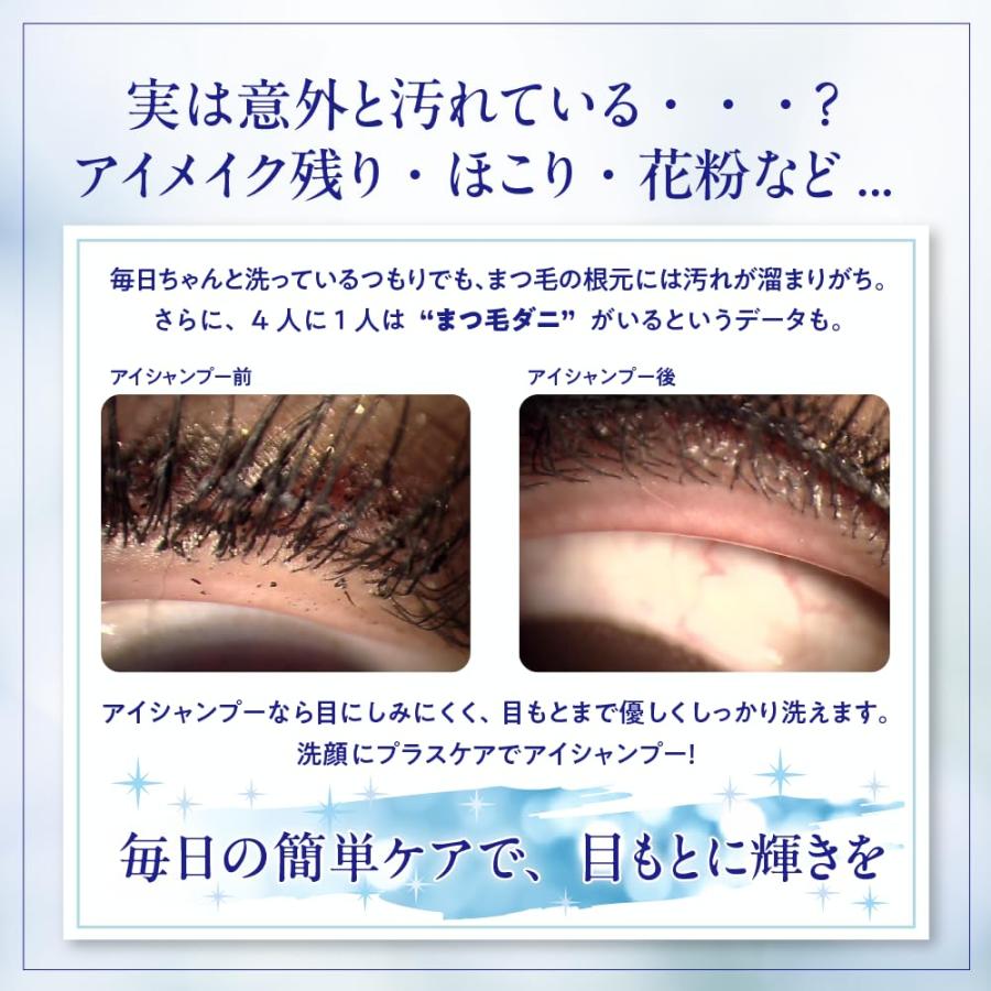 アイシャンプー リフレッシュ 95mL まつ毛シャンプー 広島倉庫 : Tech