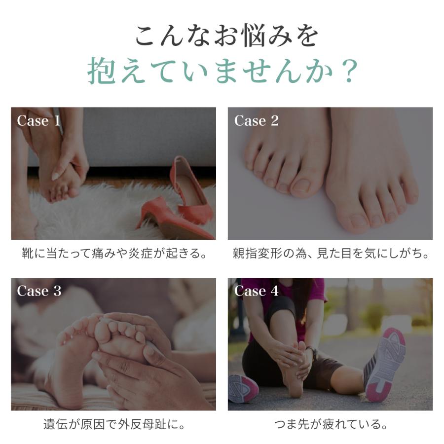 ゲル付 外反母趾サポーター 外反母趾対策 Tech Love 足指 サポーター 秋 オーバープロネーション 足の形 歩き方 靴 ダイヤル式 矯正 男女兼用 対策用品 親指 Tl130af Techlove Onlineshop 通販 Yahoo ショッピング