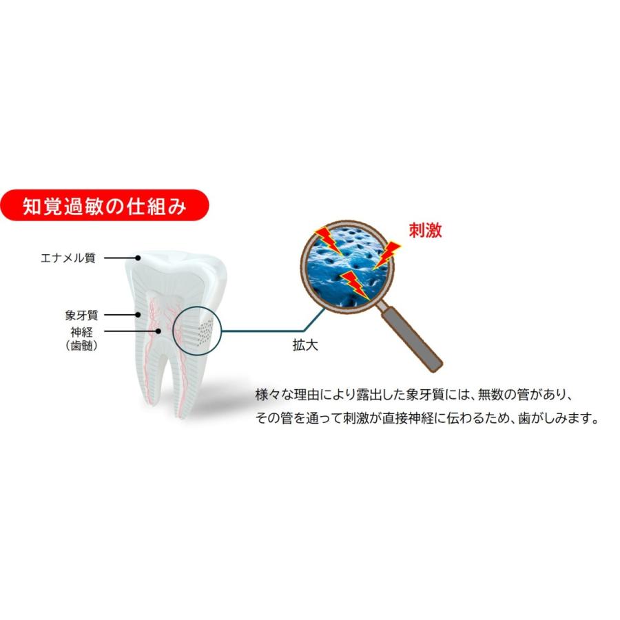 SALE／87%OFF】 知覚過敏予防 歯磨き剤 メルサージュヒスケア 80g 1本 松風 luckyoldcar.com