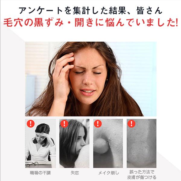 毛穴クリーン 毛穴吸引器 美顔器 Usb充電式 ニキビ吸引 黒ずみ吸出 しわ減少 Usb充電式 角栓クリア 美肌効果 フェイスケア 4種類の吸引ヘッド デジタル幸便 通販 Paypayモール