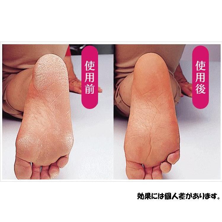 足裏全面ツルツルソックス 婦人用 あったか 靴下 暖か 保湿 かかとケア かかと ひび割れ 乾燥対策 潤い 日本製 |  | 09
