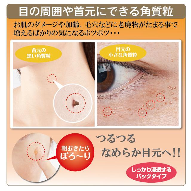 薬用ツブ・ナイトK 医薬部外品 30g （５個セット）   シェモア 角質 薬用パック 美肌 毛穴対策 ダメージお肌に イボ対策 化粧品 効果効能 パック クリーム スキンケア 目元 ポツポツ 首元 送料無料 chez moi（シェモア） 【5のつく日】薬用ツブ・ナイトK 医薬部外品