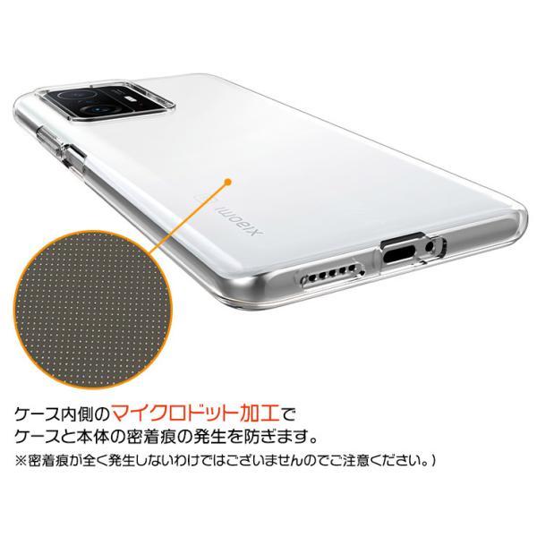 Xiaomi 11T / Pro ソフトケース カバー TPU クリア ケース 透明 無地