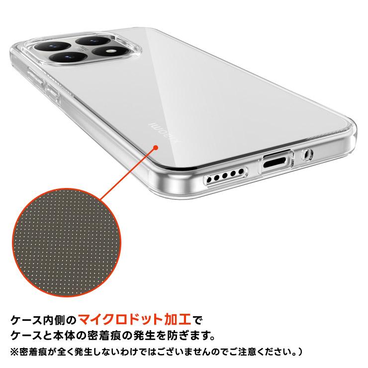 Xiaomi（シャオミ） Xiaomi 15T ケース Xiaomi 15T カバー Xiaomi 15T