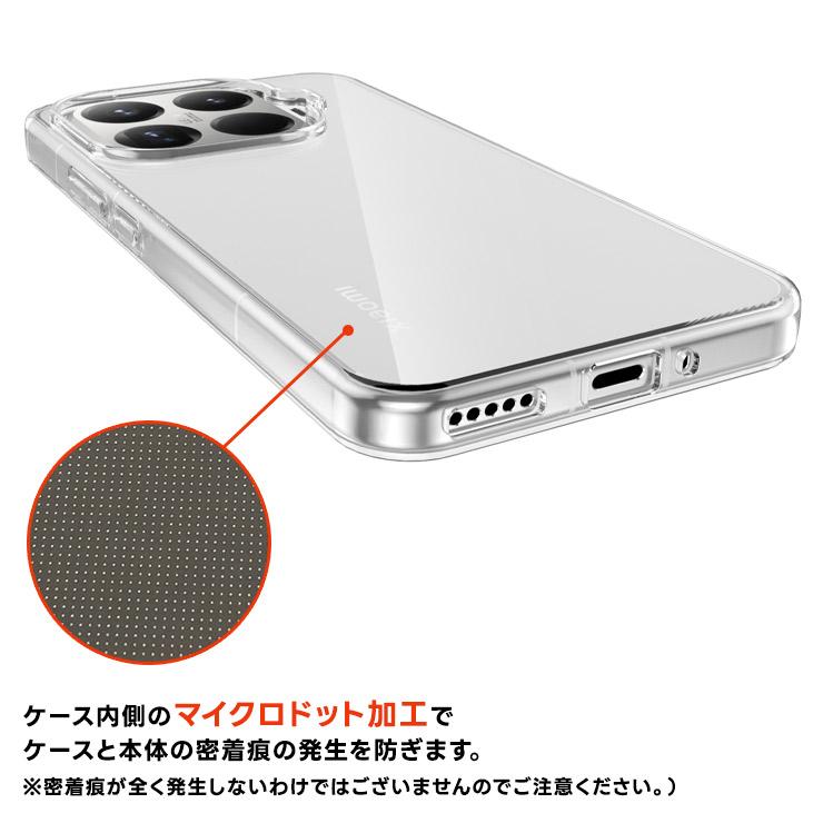 Xiaomi 15T Pro ケース クリア クリアケース カバー xiaomi 15t pro