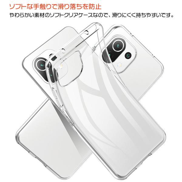 Xiaomi Mi 11 Lite 5G ソフトケース カバー TPU クリア ケース 透明