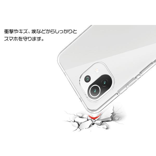Xiaomi Mi 11 Lite 5G ソフトケース カバー TPU クリア ケース 透明
