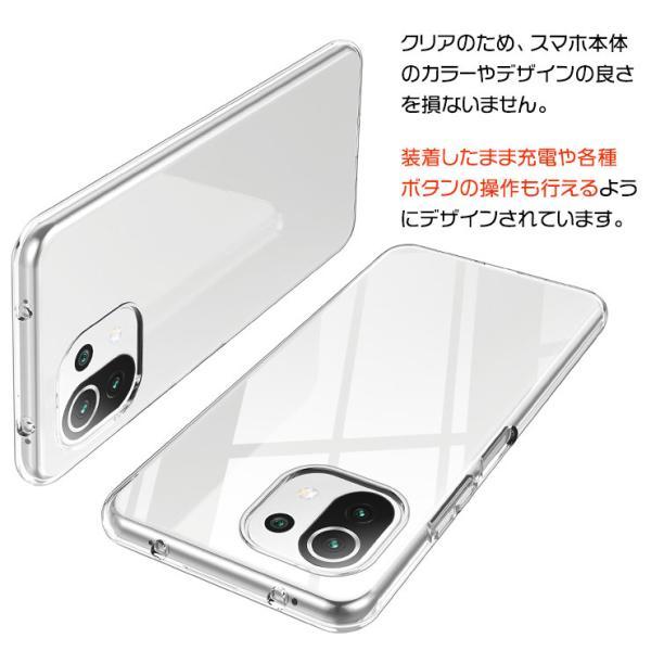 Xiaomi Mi 11 Lite 5G ソフトケース カバー TPU クリア ケース 透明