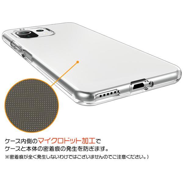 Xiaomi Mi 11 Lite 5G ソフトケース カバー TPU クリア ケース 透明