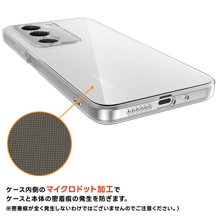 Xiaomi（シャオミ） REDMI 15 5G ケース クリア REDMI 15 5G カバー