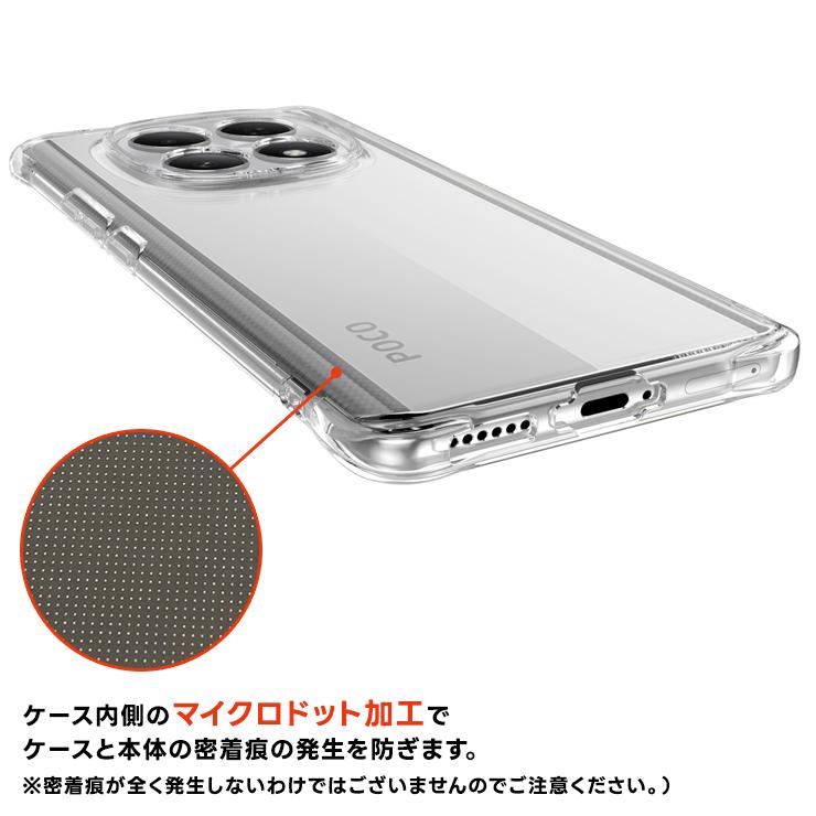 REDMI Note 15 5G POCO M8 ケース カバー クリア Xiaomi 透明 耐衝撃