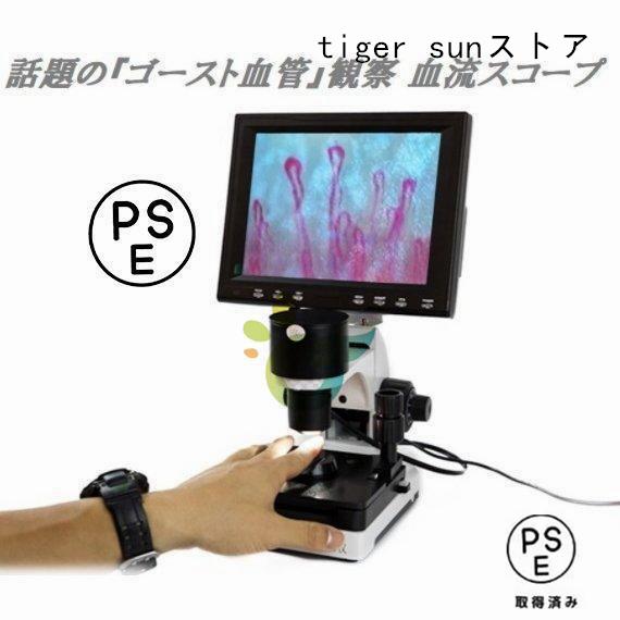 観察 血流スコープ◆毛細血管 顕微鏡 880+600倍+8インチ画面をクリア（Yahoo!・tiger sunストア）