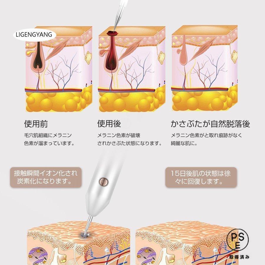 レーザーペン レーザー除去ペン 美顔器 シミ取り イボ 口コミ シミ