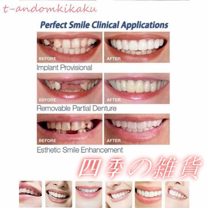 義歯 仮歯 3色セット 抜け歯 欠け歯 つけ歯 差し歯 入れ歯 : tiger sun