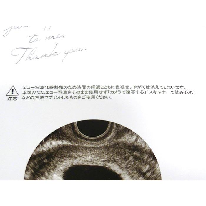 写真立て フォトフレーム 赤ちゃんのエコー写真が飾れる マタニティフレーム ・ゴールド 0812-35　プレゼント ギフト | ブランド登録なし | 08