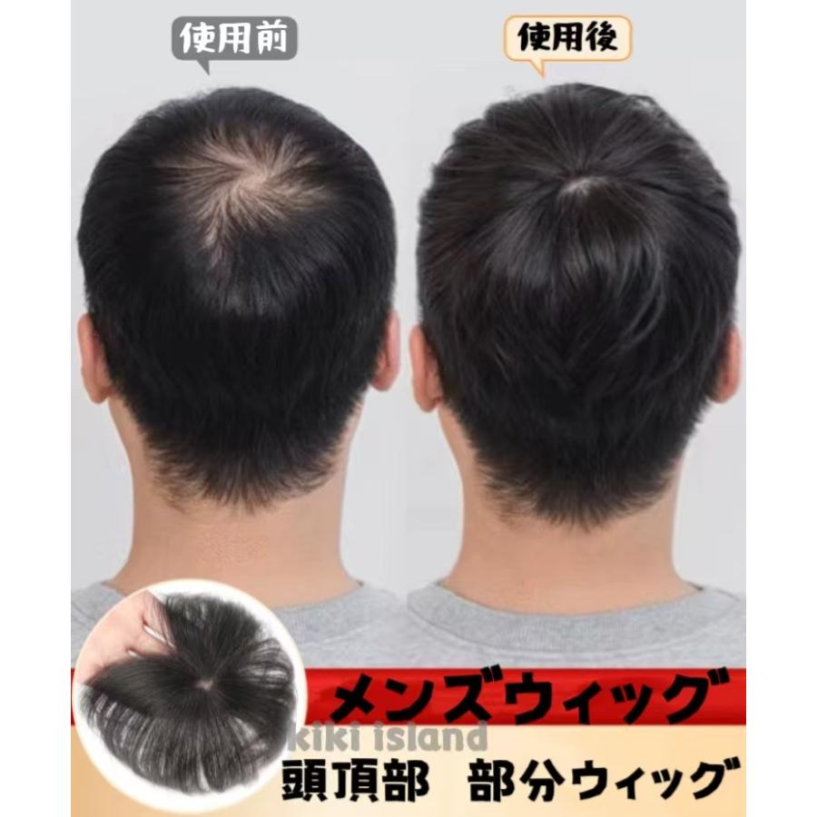 メンズウィッグ 頭頂部 部分 ウィッグ 自然 ウィッグ 男性用 自然