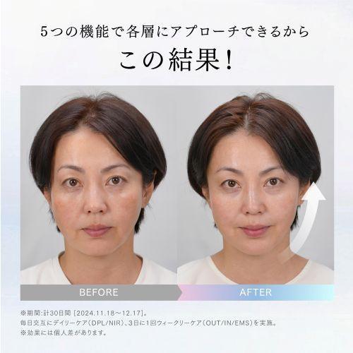 マイトレックス(MYTREX) MT-MRO-24B ブラック MYTREX MiRAY ONE マルチ