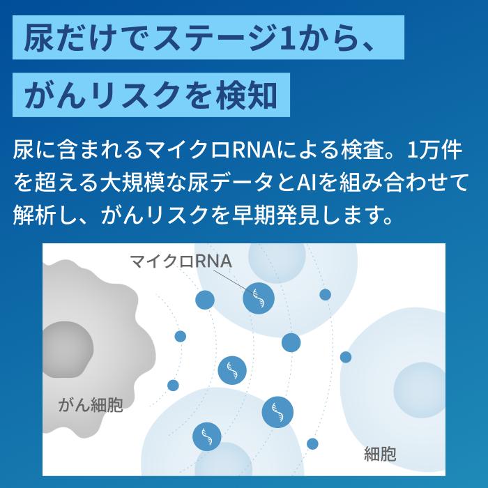 尿がん検査 マイシグナル・スキャン 世界初 がんリスクの早期発見 尿