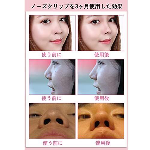 鼻セレブ 鼻プチ ノーズクリップ 鼻 鼻クリップ 鼻高く 美鼻 鼻筋矯正 鼻栓 鼻痩せ 鼻小さく 団子鼻 豚鼻 低い鼻 小鼻 補正 整形 簡単 1日3 S 通販ショップ トマト ヤフー店 通販 Yahoo ショッピング