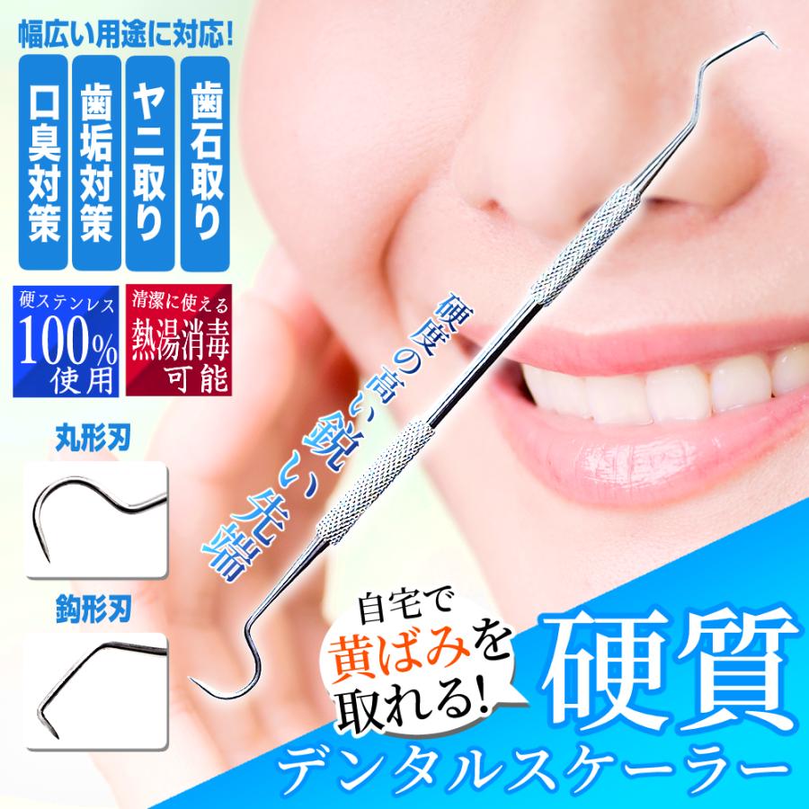 自宅で黄ばみ除去! 硬質タイプ デンタルスケーラー 毎日のチェックに 簡単ケア 歯垢 ヤニ取り 歯石取り 歯科 / 犬 猫 ペットにも :19DCDS12SL-001:雑貨販売店ROOOMA - 通販 - Yahoo!ショッピング 自宅で黄ばみ除去! 硬質タイプ デンタルスケーラー 毎日のチェックに 簡単ケア 歯垢 ヤニ取り 歯石取り 歯科 / 犬 猫 ペットにも :19DCDS12SL-001:雑貨販売店ROOOMA - 通販 - Yahoo!ショッピング