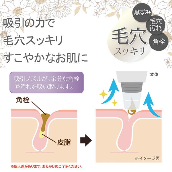 【期間限定割引】毛穴スコープ＆吸引器 617fNOEZIgL.jpg_BO30,255,255,