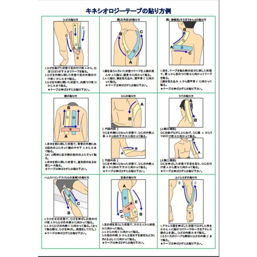 Trinox トリノックス キネシオロジーテープ 1巻 5ｃｍ 5ｍ 野球 腰痛 健康 スポーツ 肩こり解消 相撲 筋肉痛 スポーツ アウトドア Trinox Kin 01 トリノックスストア 通販 Yahoo ショッピング