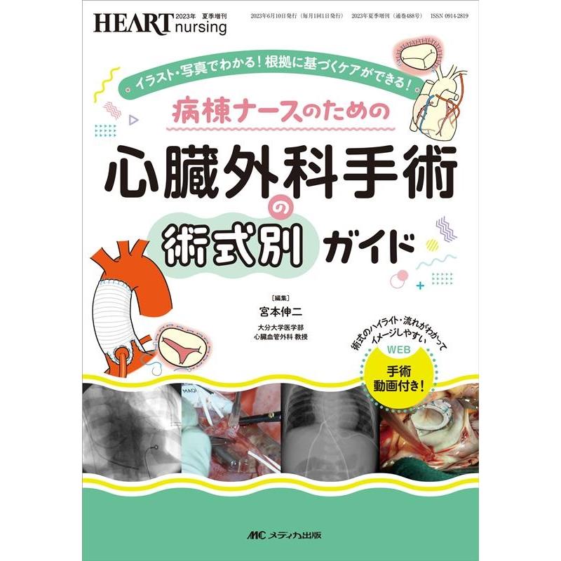 宮本伸二 病棟ナースのための心臓外科手術の術式別ガイド イラスト・写真でわかる!根拠に基づくケアができる! ハートナ Book | 